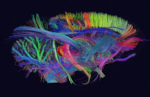 Conectoma del cerebro /Fuente: http://www.worldsstrangest.com